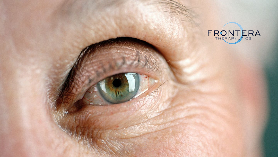 Frontera Therapeutics Advances to Phase II with FT-003 for Diabetic Macular Edema