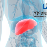 Huadong Medicine's HDM1005 Receives NMPA Approval for MAFLD/MASH Clinical Trial