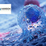Hansoh and GSK's HS-20093 Receives FDA Breakthrough Therapy Designation for Osteosarcoma
