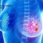 Kelun-Biotech's Anti-HER2 ADC A166 Receives NMPA Review for Expanded Indication