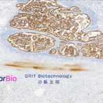 Inceptor Bio and GRIT Biotechnology Partner to Advance CAR-T Therapy IB-T101 for Solid Tumors