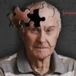 Johnson & Johnson's Posdinemab Receives FDA Fast Track Designation for Alzheimer’s Disease
