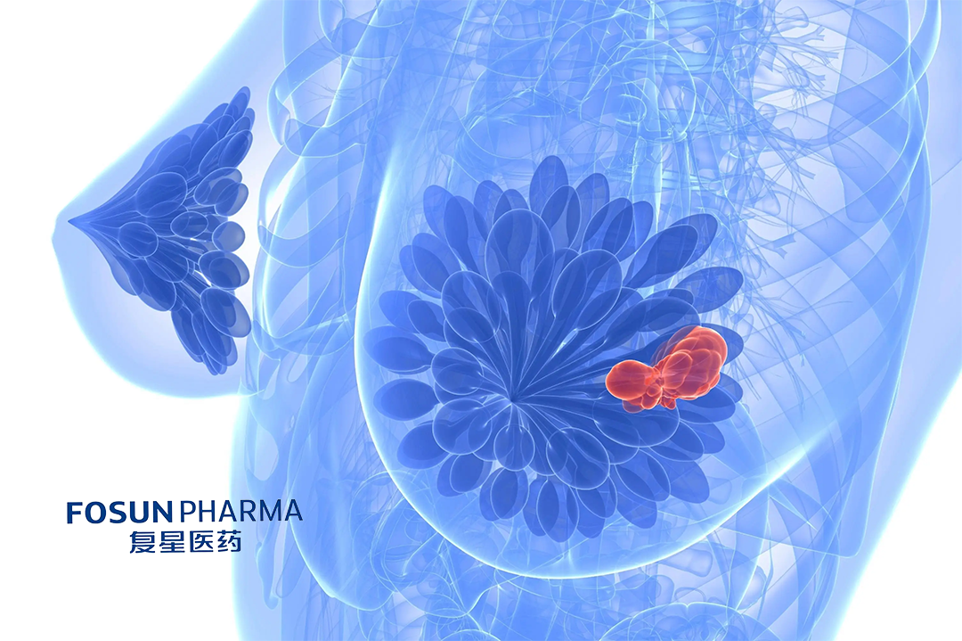 Fosun Pharmaceutical's FCN-437c Accepted for NMPA Review for Breast Cancer Treatment