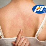 Hengrui Pharmaceuticals Gets NMPA Approval for SHR-1819 Phase II Study