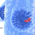 Eli Lilly to Acquire Scorpion Therapeutics' STX-478 for $2.5B