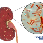 Fosun Pharma Initiates Phase II Study for Glomerular Disease Treatment