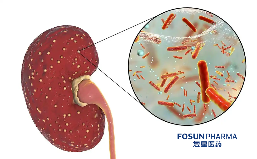 Fosun Pharma Initiates Phase II Study for Glomerular Disease Treatment