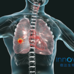 Innovent's Limertinib Wins NMPA Approval for NSCLC Treatment