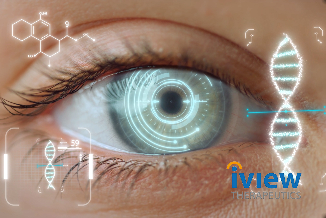 IVIEW Therapeutics Secures Series A++ Funding for Ophthalmology Pipeline