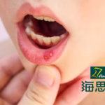 Haisco's HSK44459 Approved for Clinical Trials in Behcet's Disease