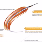 Sino Medical Sciences' NC Rockstar Catheter Gains MDA Approval in Malaysia