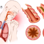 Sino Biopharmaceutical's Tulobuterol Patch Gains NMPA Approval