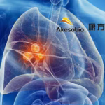 Akeso Completes Enrollment for Global Phase III Trial of Ivonescimab in Lung Cancer