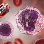 Merck Initiates Phase III waveLINE-010 Study for Zilovertamab Vedotin in DLBCL