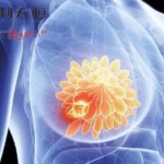 Biokin Pharmaceutical's BL-M07D1 Gains NMPA Approval for Phase III Study