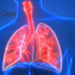 Regend Therapeutics' Pulmovinci Receives FDA Orphan Drug Designation for IPF