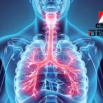 CSPC Pharmaceutical's Omalizumab Biosimilar Wins NMPA Approval for Allergic Asthma