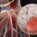 Henlius Biotech Doses First Patient in HLX43 Phase II Study for Esophageal Cancer