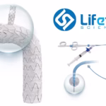 Lifetech Scientific's Aortic Stent Graft System Wins NMPA Approval