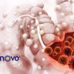 Eli Lilly Acquires Organovo's FXR Program for Inflammatory Bowel Disease