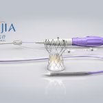 Peijia Medical Completes First Two Implants of Trilogy THV System in Taiwan