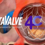 4C Medical Lands $175M Series D to Advance AltaValve TMVR System