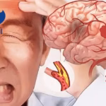 Jiangsu Hengrui Pharmaceuticals Receives NMPA Approval for HRS-4029 in Acute Ischemic Stroke