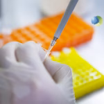 Biogen Initiates TRANSCEND Study for Felzartamab in Late AMR Kidney Transplant Patients