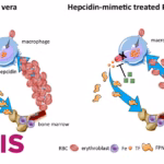 Ono Pharmaceutical Licenses Ionis' Sapablursen for Global Development in Polycythemia Vera