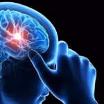 Jiangsu Aidea's AD108 Receives NMPA Approval for Acute Ischemic Stroke