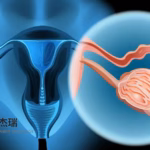 Alphamab Oncology's JSKN033 Receives Breakthrough Therapy Designation for Platinum Resistant Ovarian Cancer