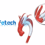 Lifetech Scientific's Aortic Stent System Approved by China's NMPA