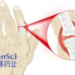 Changchun High & New Technology Industries Receives US Trial Approval for GenSci120 in Rheumatoid Arthritis