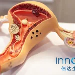 Innovent Biologics Doses First Patient with IBI354 in HeriCare-Ovarian01 Study