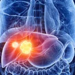 FDA Issues Second CRL to Hengrui's Camrelizumab Combo Due to Manufacturing Issues