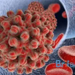 Brii Biosciences Presents Elebsiran Phase II Data at APASL 2025 Meeting