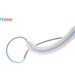 Shanghai Bio-heart Launches SAKURA-SCB Study for Drug-Coated Balloon in Japan