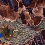 Hengrui Pharmaceuticals Secures Clinical Trial Approval for HRS-9813 in IPF
