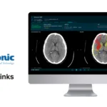 Medtronic Partners with Methinks AI to Enhance Stroke Care in Emerging Markets
