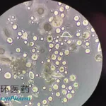 Sihuan Pharma's Polycaprolactone Microsphere Filler Gains NMPA Approval