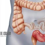 Sunshine Guojian's SSGJ-627 Gains NMPA Approval for Ulcerative Colitis Trial