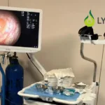 Lynmou Medical Secures Series A Funding for Endoscope Expansion