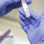 SinoMab BioScience's SM17 Shows Promising Results in Phase Ib Atopic Dermatitis Study