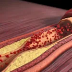 Winsunny Pharma's FY101 Gains NMPA Clinical Approval for Hyperlipidemia