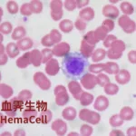 HemaCell's XJ-MK-002 Gains FDA Orphan Drug Designation for Giant Platelet Syndrome