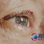 Zhaoke Ophthalmology Launches Phase II Study for Brimochol PF in Presbyopia Treatment