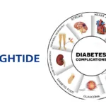 HighTide Therapeutics' HTD1801 Shows Positive Phase III Results in Type 2 Diabetes Treatment