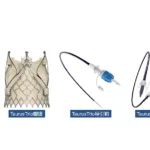 Peijia Medical's TaurusTrio TAV System Accepted for NMPA Review in China