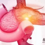 Hansoh Pharmaceutical Gains Clinical Approval for KRAS G12D Targeted Drug HS-10529