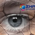 Zhaoke Ophthalmology Enrolls First Patient for Cyclosporine A Eye Gel Phase III Study